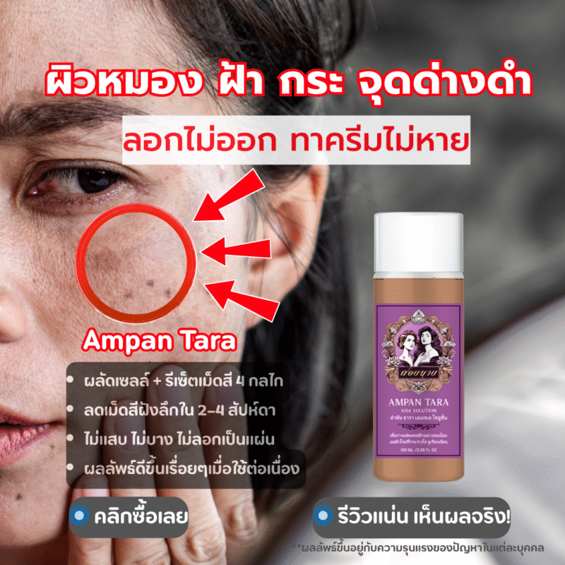 รักษาฝ้าที่ไหนดี