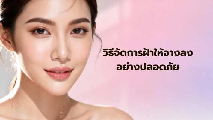 วิธีจัดการฝ้าให้หายขาดอย่างปลอดภัย