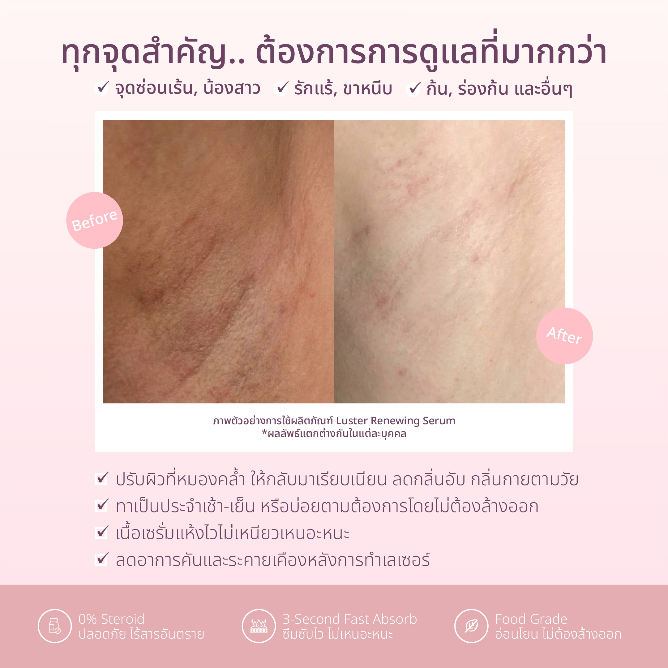 Lady Secret Whitening Soap และ Luster Renewing Serum