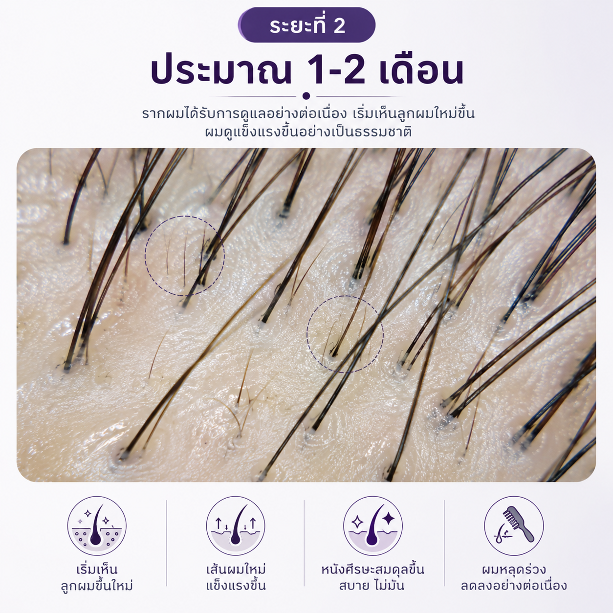 เซรั่มปลูกผมยี่ห้อไหนดี