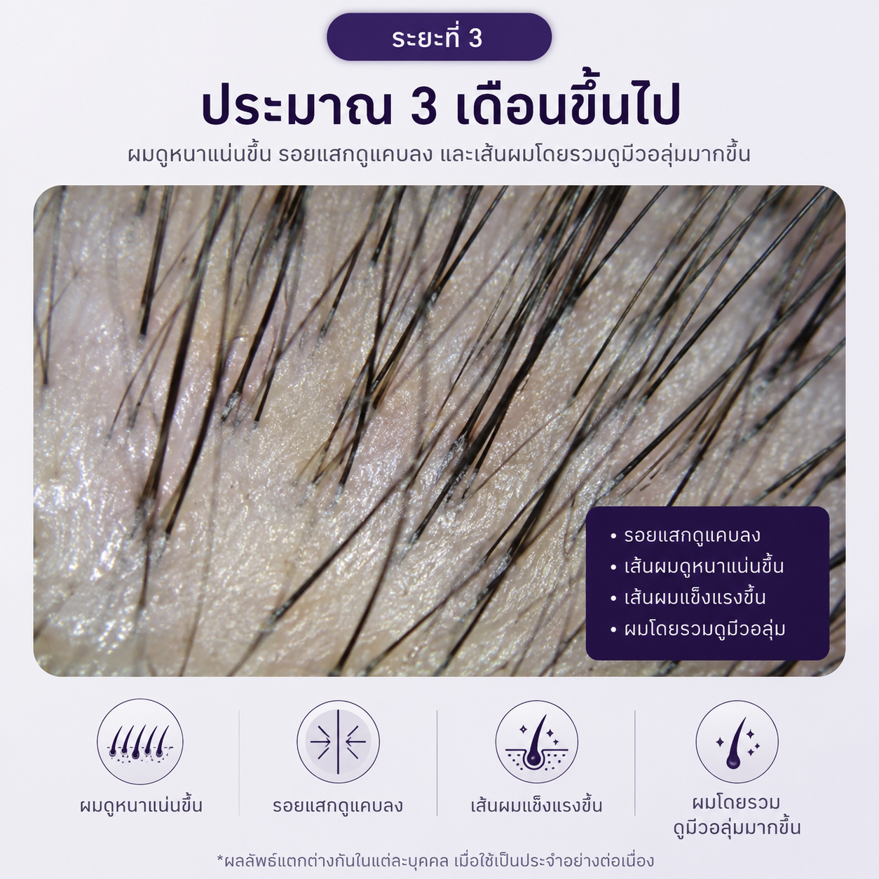 เซรั่มปลูกผมยี่ห้อไหนดี
