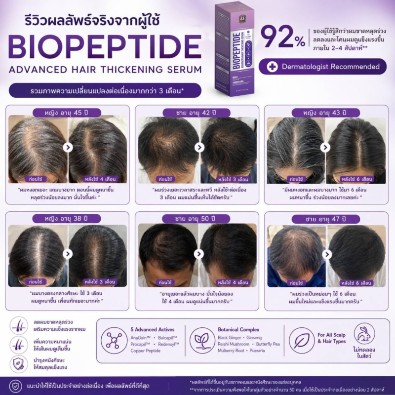 เซรั่มปลูกผมสองนาง biopeptide