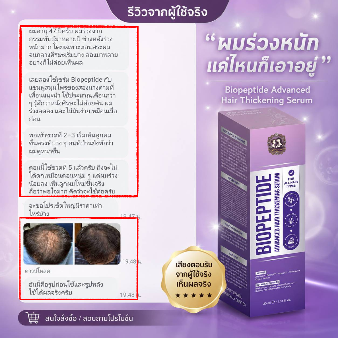 รีวิว Songnaang Biopeptide Advanced Hair Serum จากผู้ใช้จริง