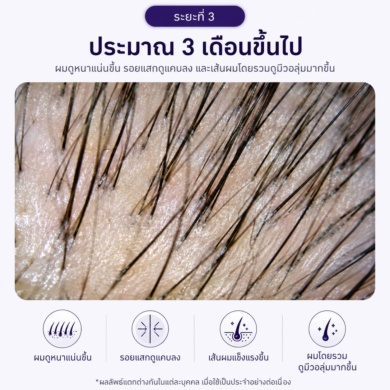 Choosing a scalp and root-care serum